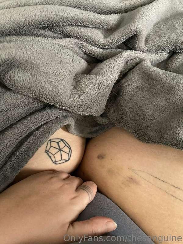 I'm so excited to show you where these bruises on my thighs ..