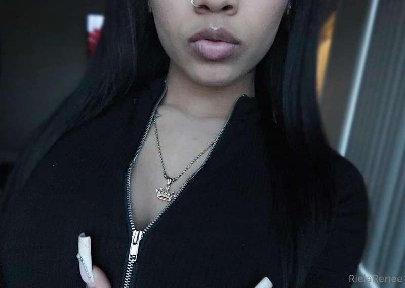 My lips r pretty but I wanna get them done