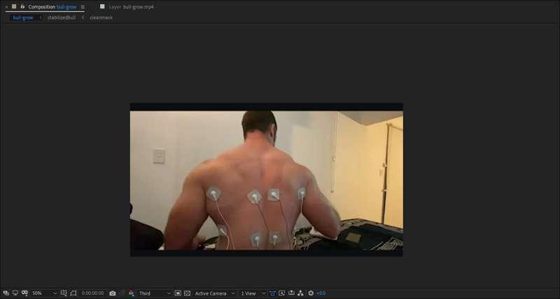My Pain in Pictures