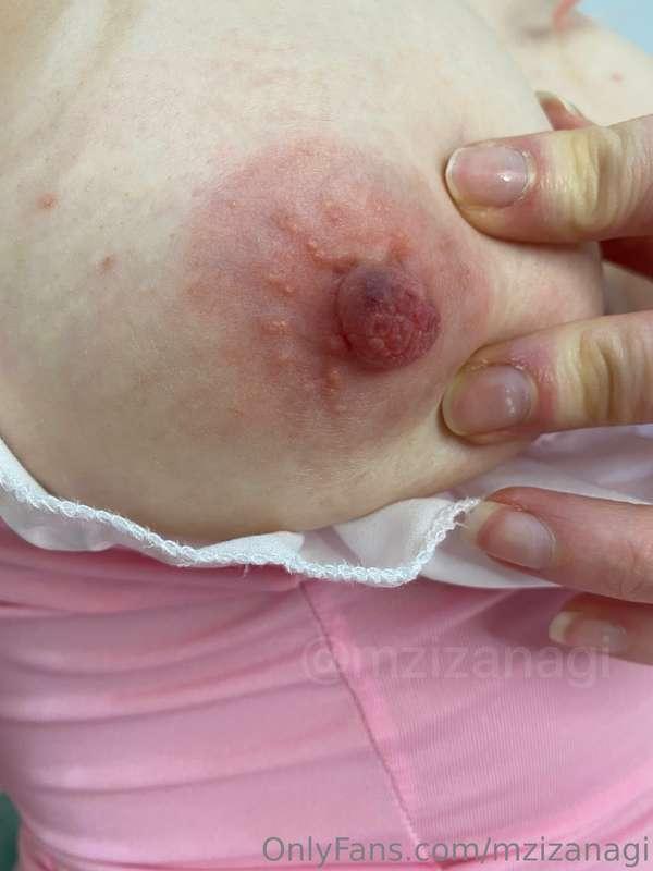 my sore lil tiddies after wearing clamps 🥵💗 i love wearing c..