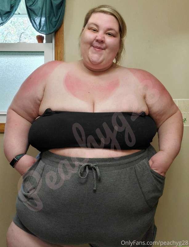 I may have gotten a little too much sun yesterday 🌞

Who wan..