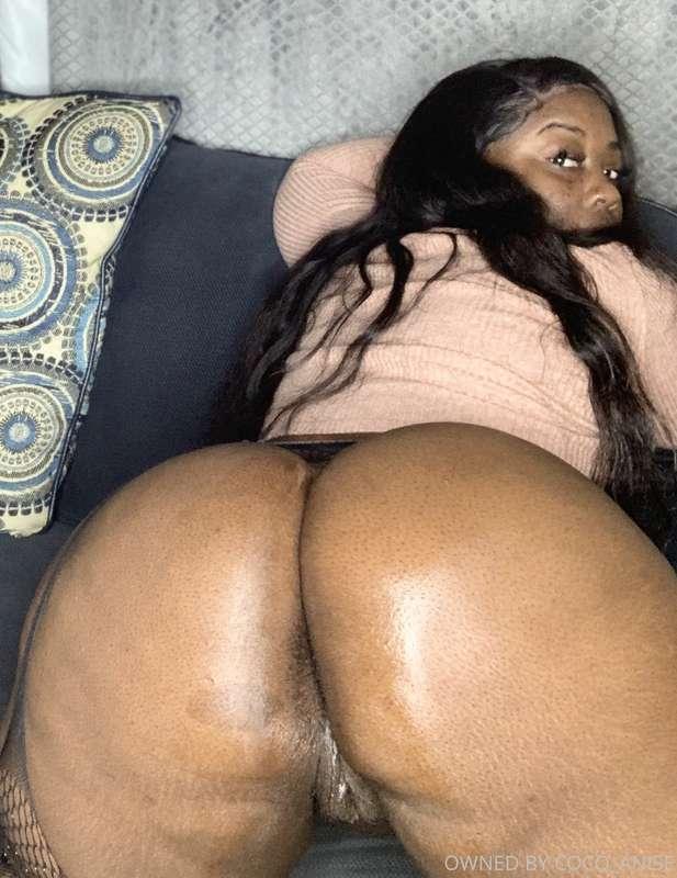 Tell me what you think about my birthmark 😌😘