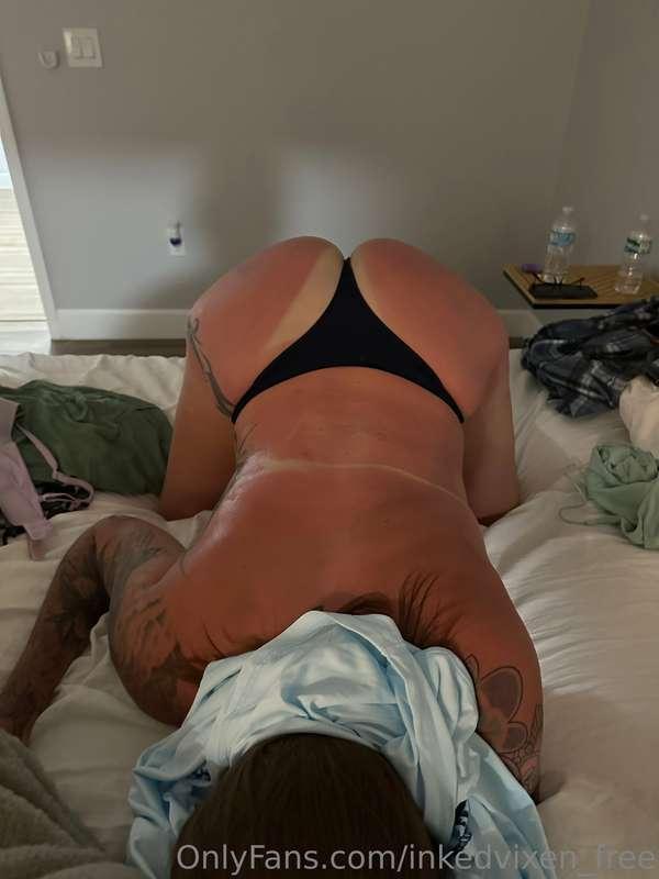 Who can rub aloe on me gently? I’m so burnt 😭