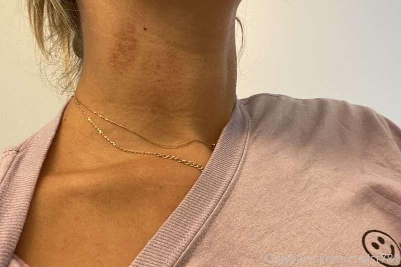 Would you mark your territory? 😅 🙃