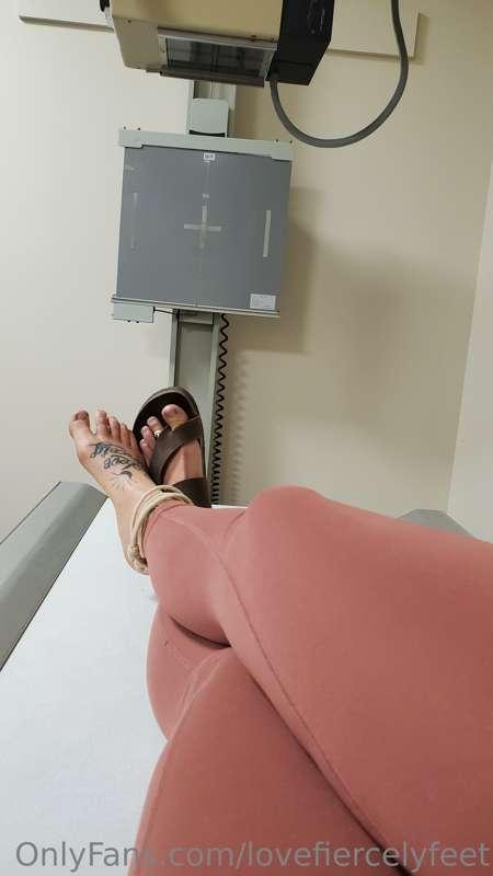 That time I broke my foot and had to get a bunch of xrays.  ..