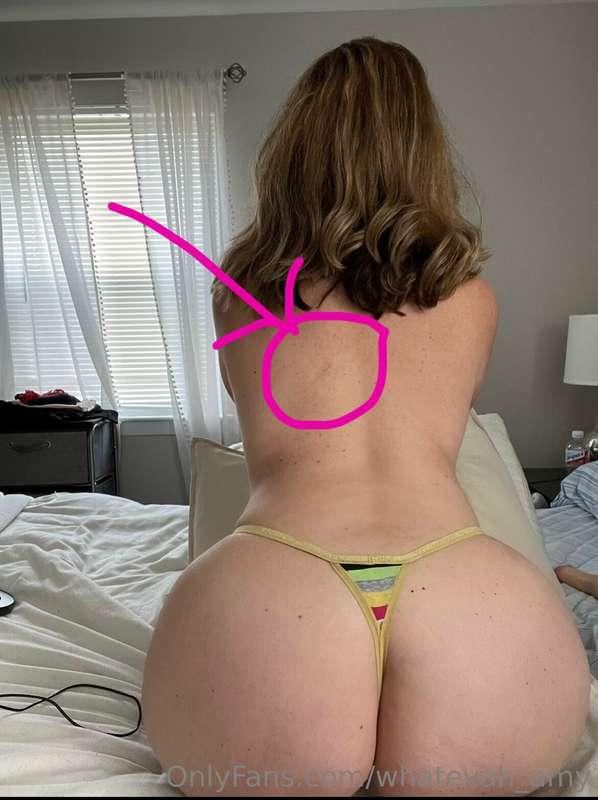 Guess how I got this little scar on my back? Best guess gets..