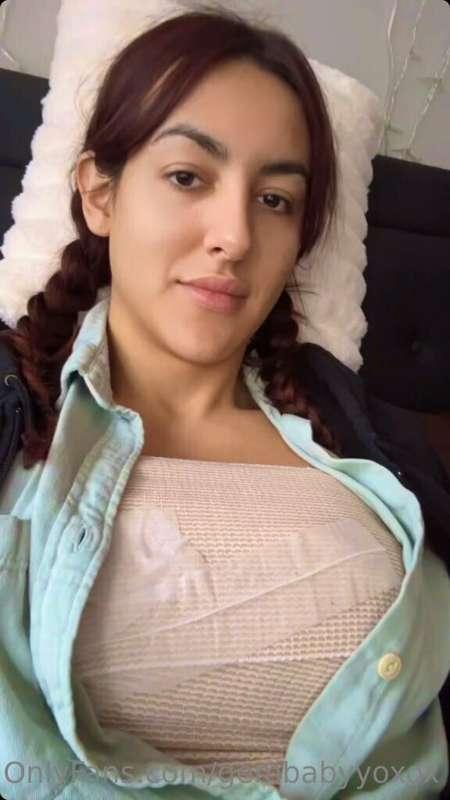 3 days post operation and I’m feeling much better after a su..