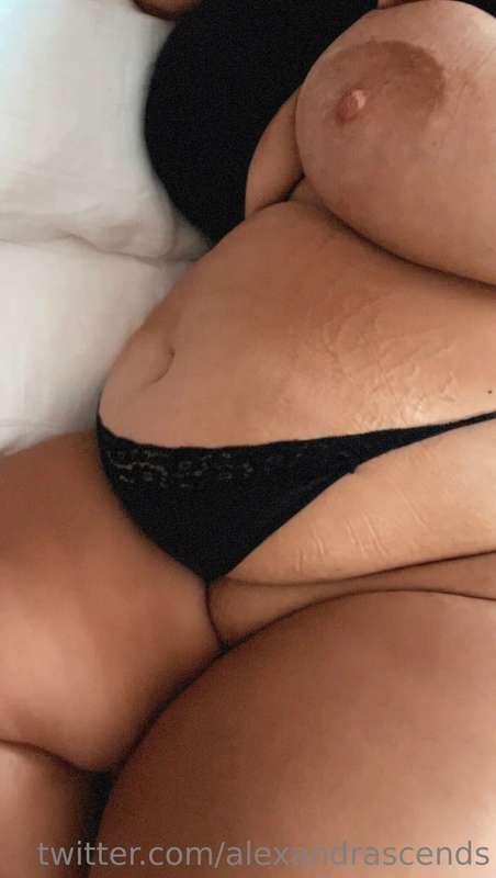 Side views and stretch marks