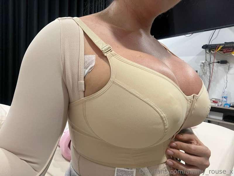 My loves, I tell you that I operated on my breasts and other..