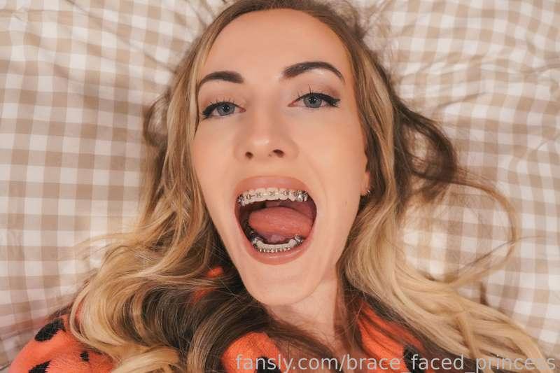 brace_faced_princess image #9