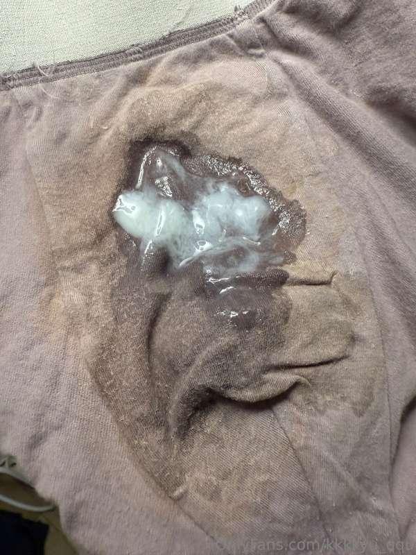 요즘 정액량이 많아짐