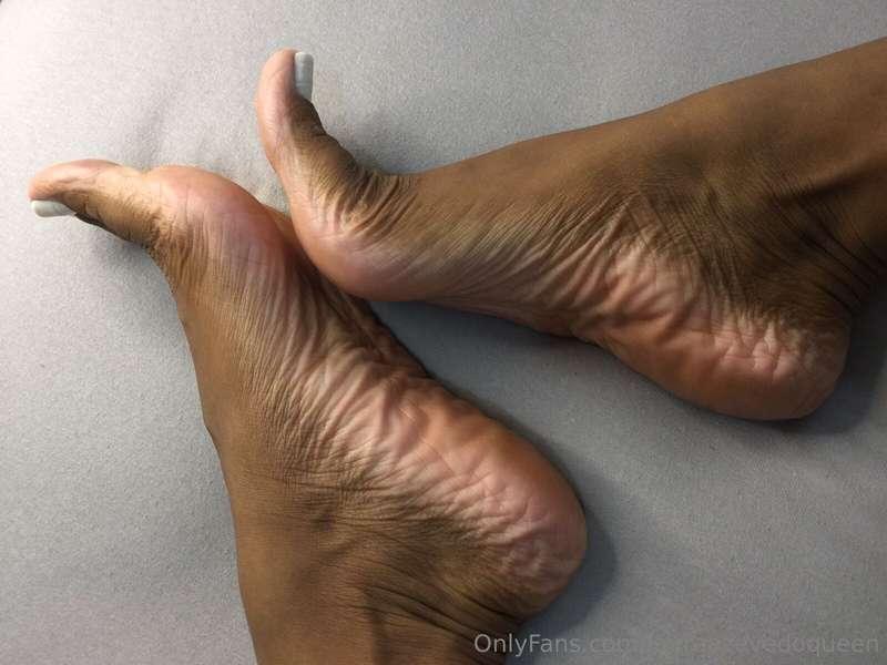 Wrinkles!