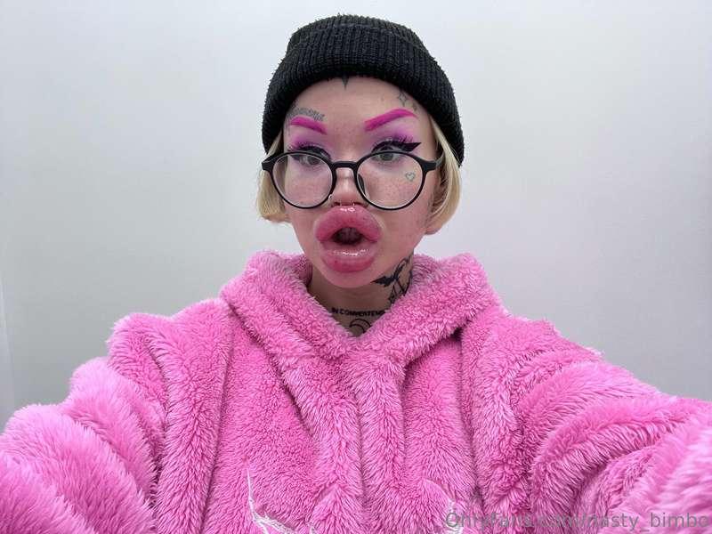 Made these pics right after getting lip fillers last week! D..