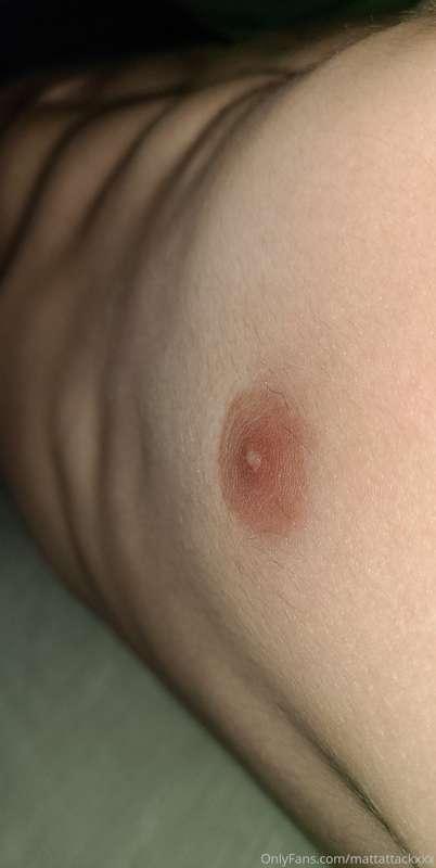 mattattackxxx image #7