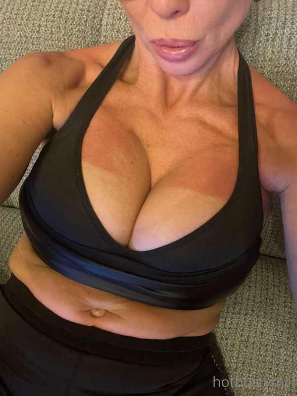 decided to redden 🌞🍑the skin for you and burned🌞🔥