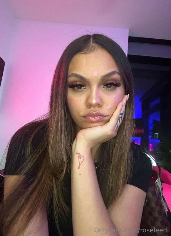 Dont mind the pimple patches 