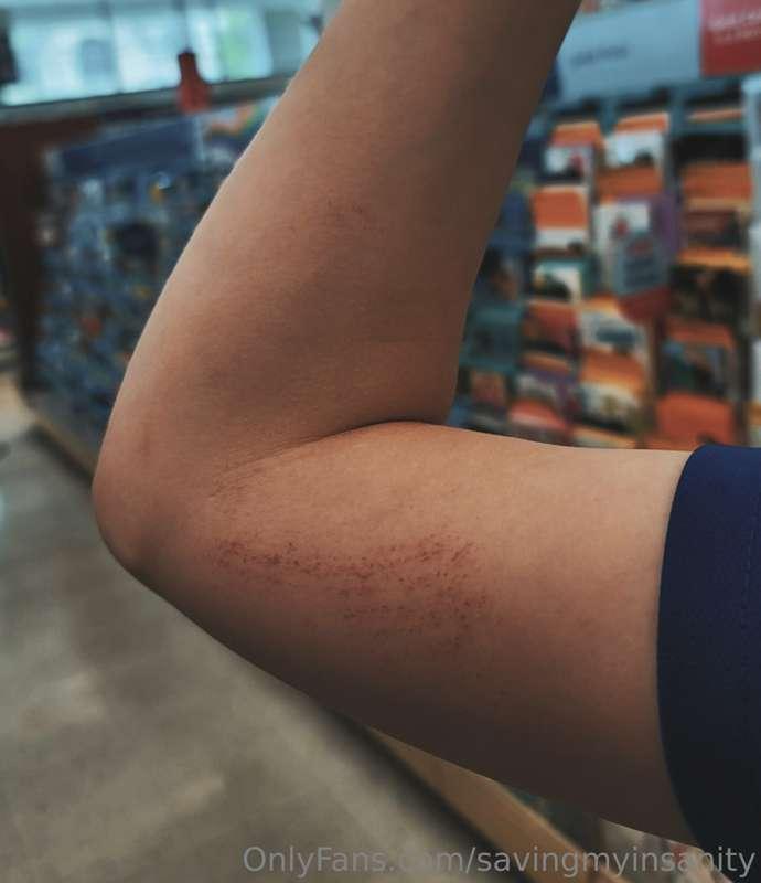 Ouch 🥺