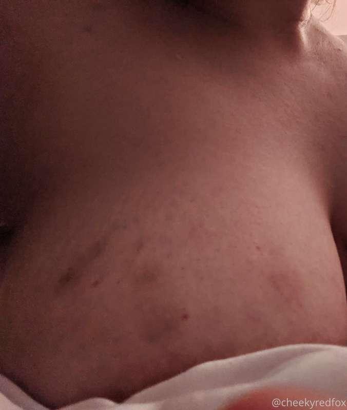 cheekyredfox image #0