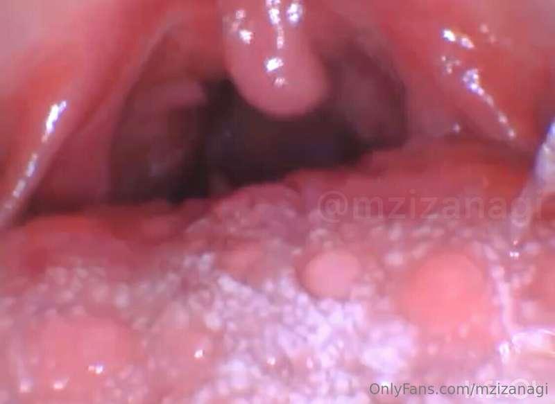 i haven’t taken any endoscope content in so long so i though..