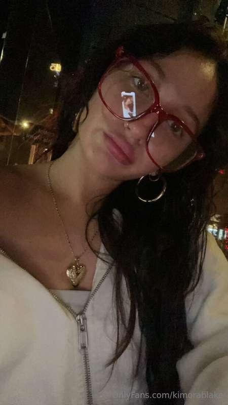 do i get more lip filler or nah 