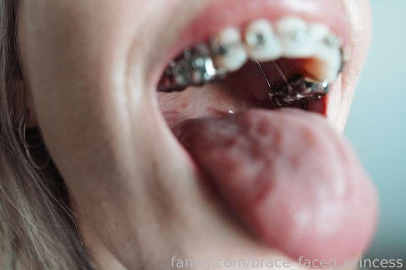 brace_faced_princess image #1