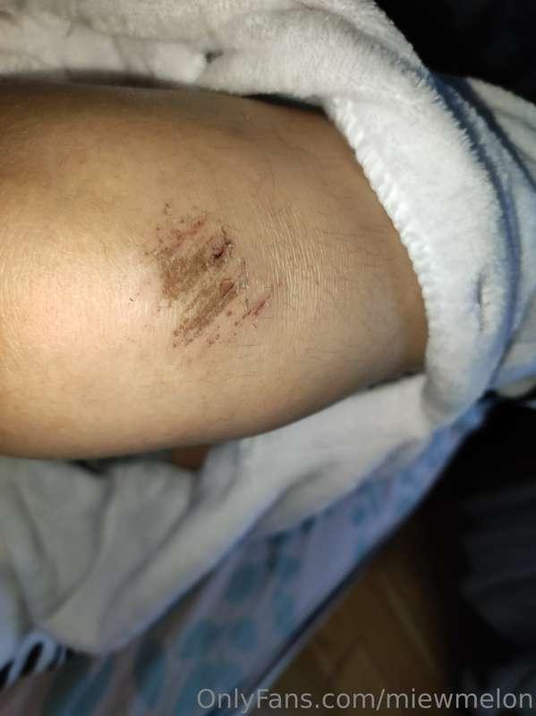 This is a terrible month for me ( ´△｀) I got covid, and an a..