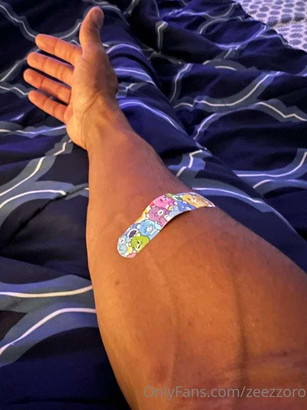 I had the 2nd dose of monkey pox shot today , it’s was injec..