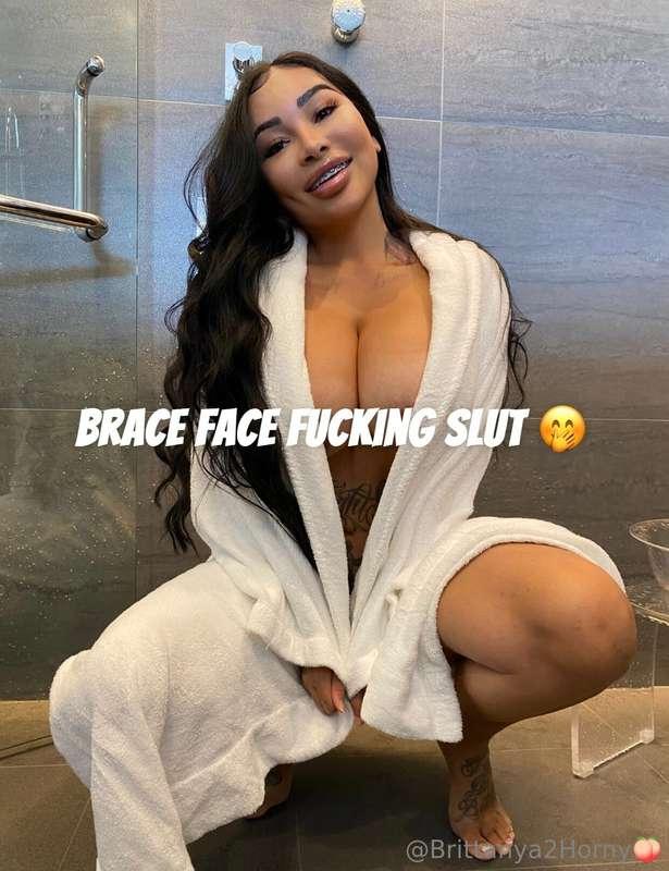 I’m your brace face slut today 🫣🤭👀😳💦💦