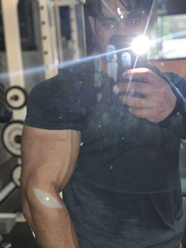 that veins...