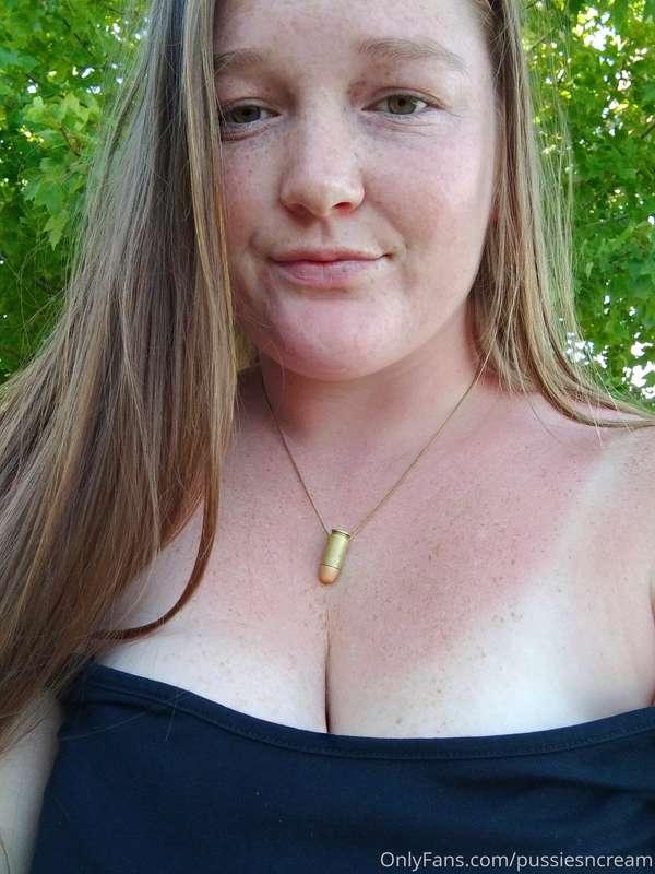 When your outside all day and forget to put on sunscreen 😅