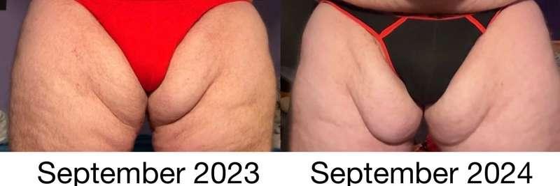 Thigh rolls comparison 