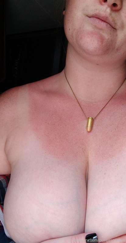 Sometimes being a ginger sucks 😅