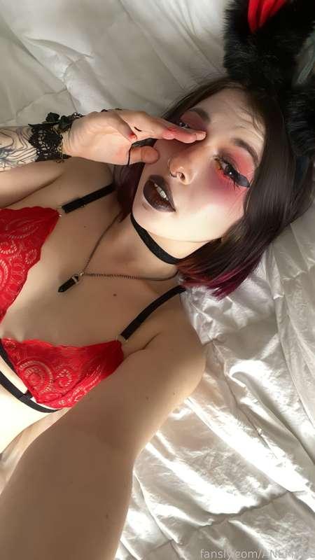 anemiaa image #2