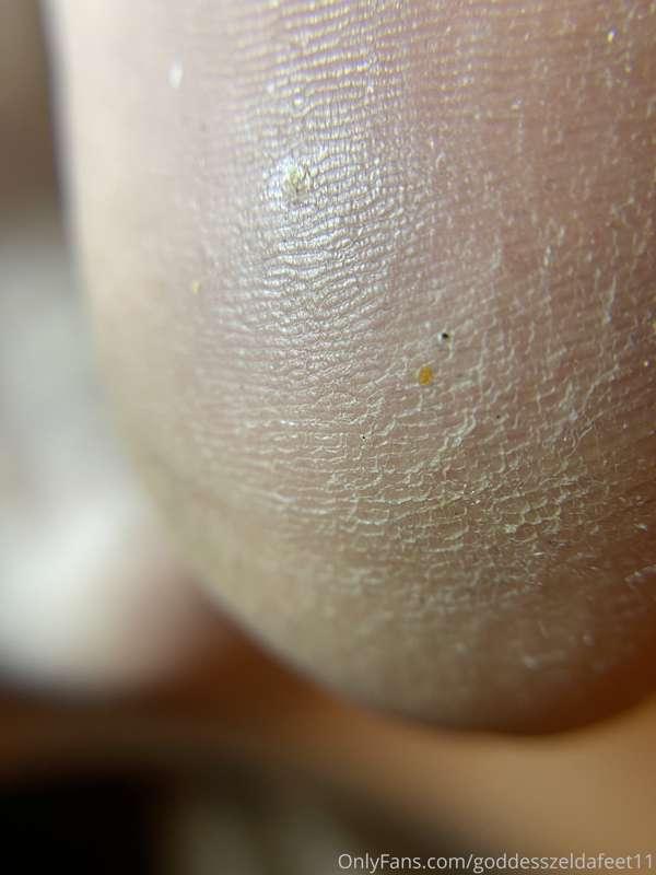 goddesszeldafeet11 image #5