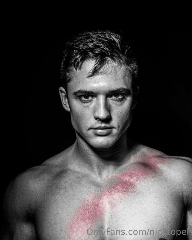 Beaten & bruised but not defeated 🕊️

**Robert McGraw shot t..