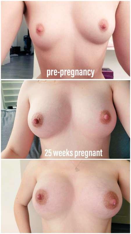 The boob saga! 😱