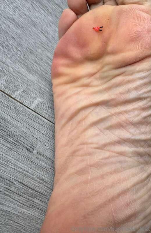 Poor little little helpless. I just received many of them. I..
