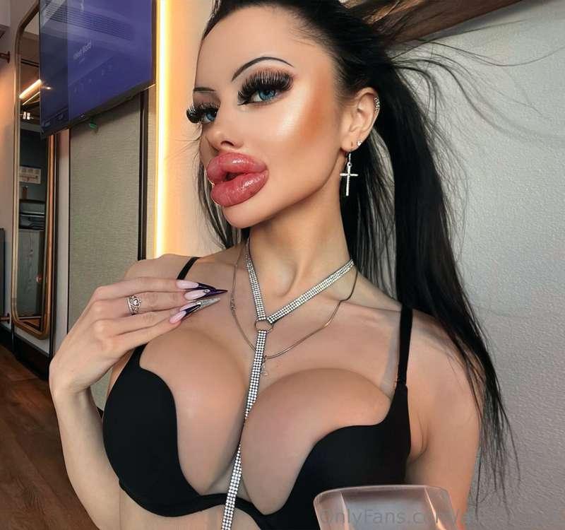My 31st augmentation 💉
Check out my new swollen lips video 💋