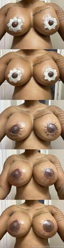 Here’s the process so far of how my boobs are healing. Each ..