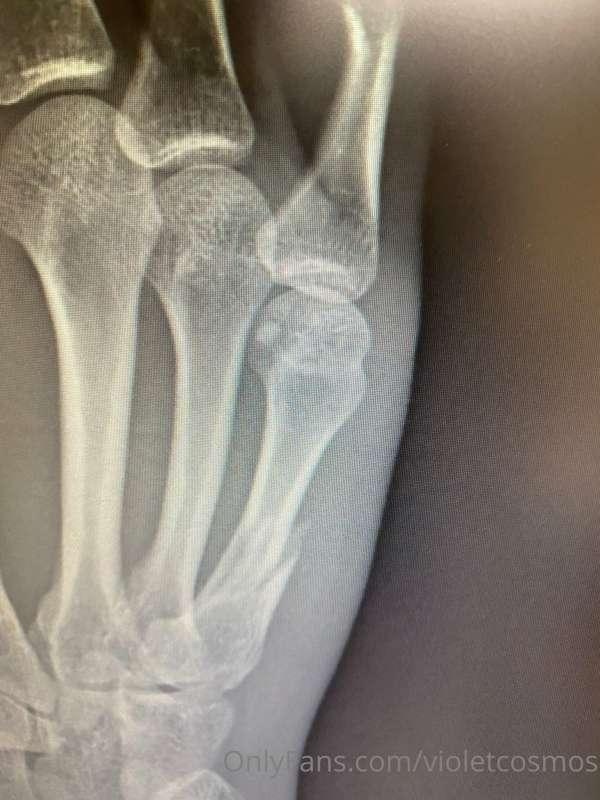 Omgoodness I’ve been so swamped since I broke my hand! And I..