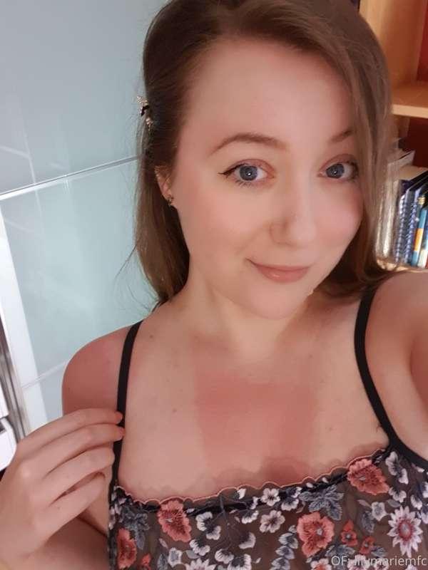 Caught a sunburn on the balcony... of course. Can you forgiv..