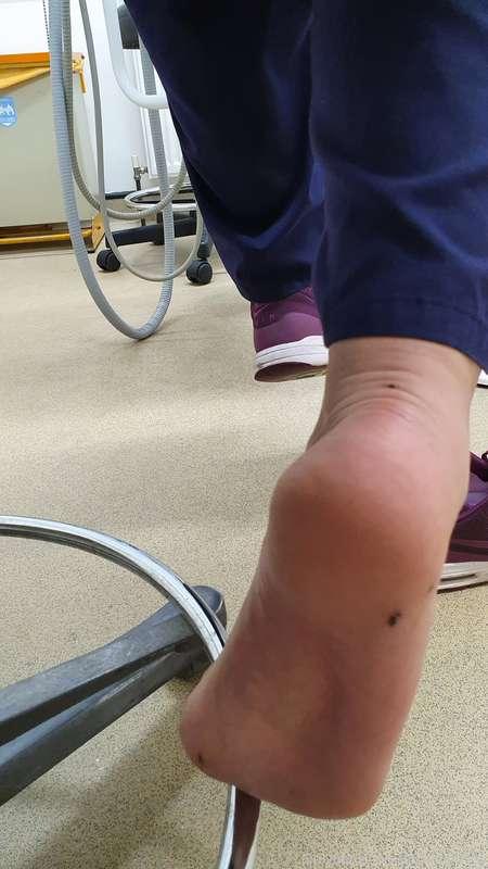 My feet at work on Christmas eve #nursefeet