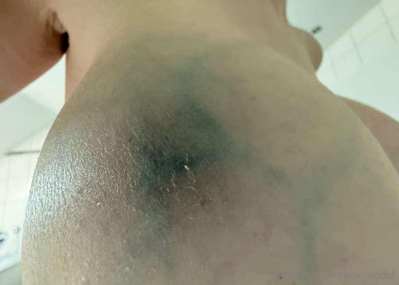 The first picture was taken just one day after the fill-up a..