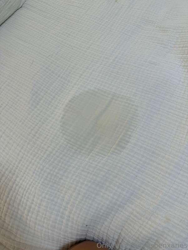 aspenxaries image #0