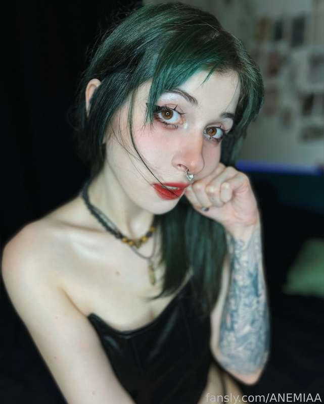 anemiaa image #3