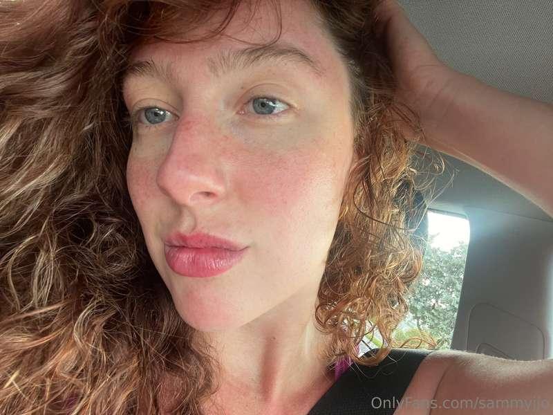 Got a sunburn 🥲