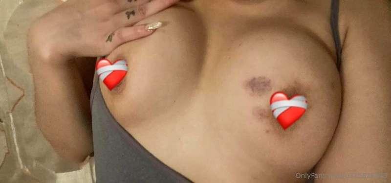 ❤️‍🩹❤️‍🩹❤️‍🩹