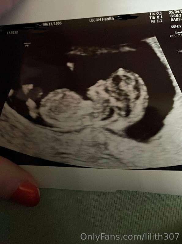 Where’s all my pregnancy fetish people at? My bumps starting..