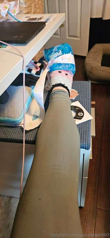 So, I um, fell down the stairs....

These socks will be reti..