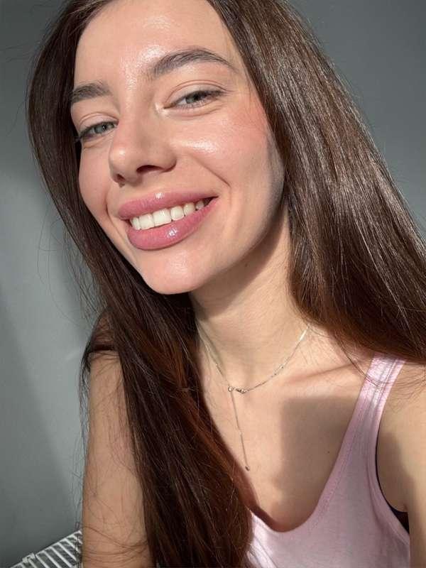 My braces were removed!how do you like it?